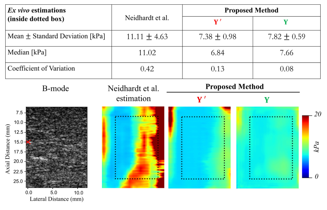 B-mode image of the swine liver beside stiffness maps from Neidhardt et al., the primary reconstruction and the denoised output, with a dotted measurement box; Neidhardt et al. shows high noisy values on the right side.